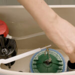 valve replacement Sydney