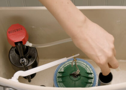 valve replacement Sydney