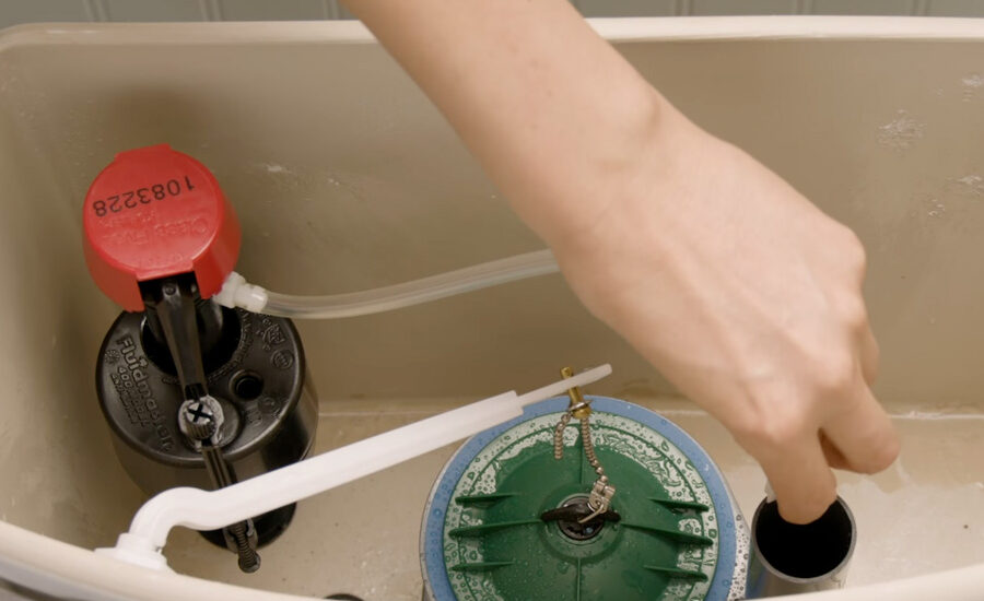 valve replacement Sydney